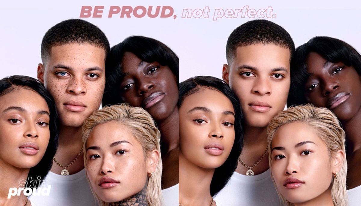 Skin Proud'un “be proud, not perfect” kampanyası